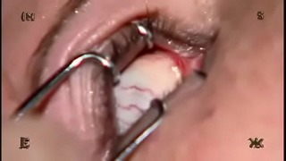 Insex——妓女妓女